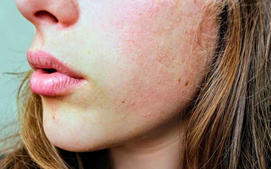 What Is Your Skin Trying To Tell You?