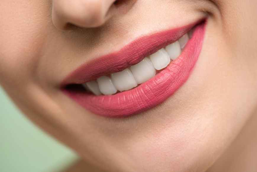 Teeth Whitening: Cost and Quality