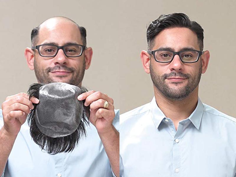 How to remove hair that pulls through your lace hair system