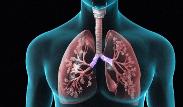 Can You Inherit the Risk for COPD?